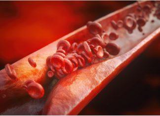 Scientists develop peptides that restore balance in gut bacteria and reverse atherosclerosis