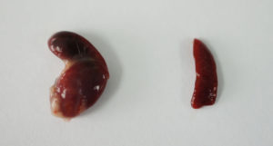Tissue Alchemy Transforms Spleen to Liver