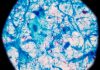 Compounds demonstrate promising activity against tuberculosis