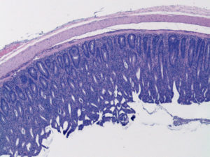 CRISPR Screen Reveals Control Knob for Regulatory T Cells
