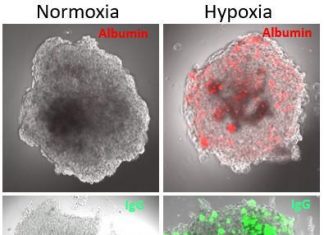 Inflammation induced blood-brain barrier dysfunction studied in organoids