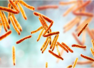 Latent tuberculosis infection in European countries closely correlates with COVID-19 infection