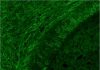 New Method for Treating Myelin Disorders Discovered