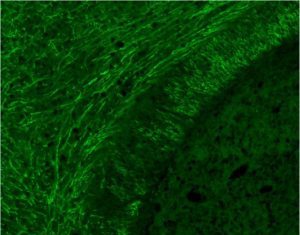New Method for Treating Myelin Disorders Discovered