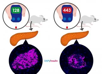 A surprising protein player in diabetes
