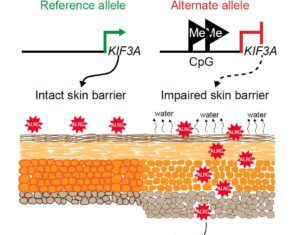 Eczema Risk Higher If Gene Variants Lower Skin Barrier