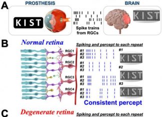 KIST finds clue to improve artificial vision for patients with retinitis pigmentosa