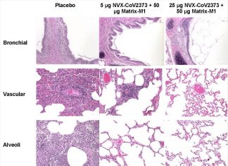 New SARS-CoV-2 vaccine effective in macaques