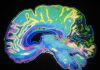 Osmotic therapy device reduces swelling in rats with spinal cord injuries
