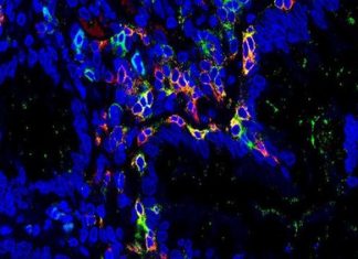 Scientist map ulcerative colitis – European Biotechnology News