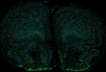 Immune Cell Signaling to the Brain Regulates Anxiety-Like Behaviors