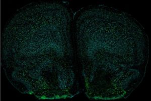 Immune Cell Signaling to the Brain Regulates Anxiety-Like Behaviors