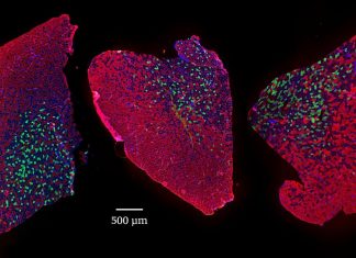 Muscle aging: Stronger for longer