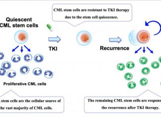 New Path for Preventing Chronic Myelogenous Leukemia Relapse Discovered