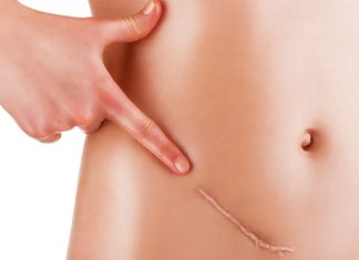 New, rapid test detects ovarian cancer more accurately