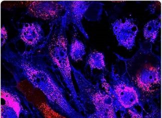 Optimized Medium for Expansion of Mesenchymal Stem Cells