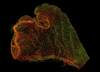 Connecting the Dots of Prenatal Inflammation and Neurodevelopment