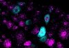 Got to Go? Scientists Uncover Gene That Helps Sense a Full Bladder