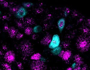 Got to Go? Scientists Uncover Gene That Helps Sense a Full Bladder
