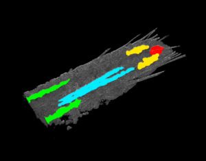 Neural Network Filters Weak and Strong External Stimuli to Help Brain Make “Yes or No” Decisions