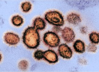 Novel mutations in SARS-CoV-2 may explain high pathogenicity of COVID-19