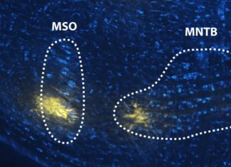 Acetylcholine Modulates Neural Activity to Parse Acoustic Signals
