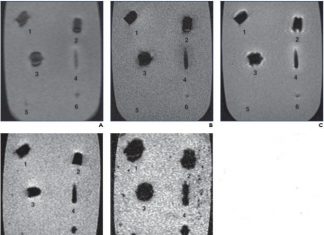 Imaging of ballistic wounds, bullet composition and implications for MRI safety