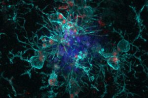 Role Identified for Brain Protein Regulated by Circadian Clock Genes in Clearing Toxic Build-up in Alzheimer’s Disease