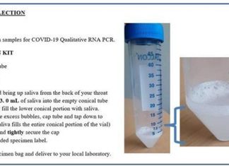 Self-collected saliva samples prove effective for diagnosing COVID-19