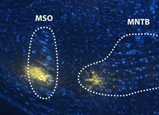 Study sheds new light on how the brain distinguishes speech from noise