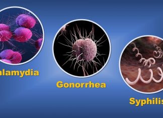 Study suggests reporting of sexually transmitted infections may be impacted by COVID-19