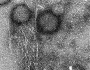Bacteria “Croak” in the Presence of Toadlet Peptide