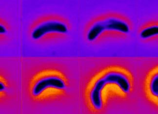 By changing their shape, some bacteria can grow more resilient to antibiotics
