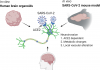 Mechanisms Underlying SARS-CoV-2 Neuroinvasion Discovered