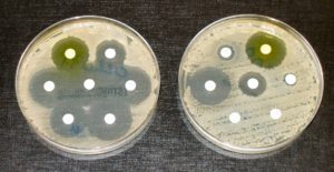 New Antimicrobial Streptomyces Species Discovered in Ancient Irish Soil