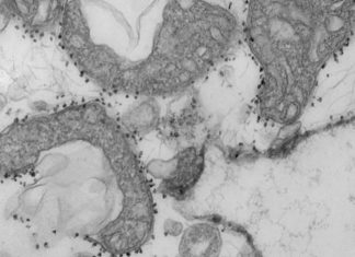 Rapid blood test identifies COVID-19 patients at high risk of severe disease