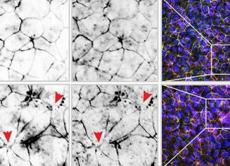 Study: e-cigarettes trigger inflammation in the gut