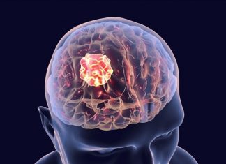 Tissue healing after brain injury could spur tumor growth