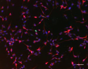 Studies Find Apple Compounds Boost Neurogenesis, May Improve Brain Function