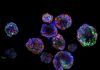 Creation of 3D organoid models to fine-tune radiation dose for nasopharyngeal cancer