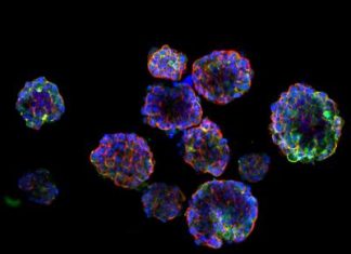 Creation of 3D organoid models to fine-tune radiation dose for nasopharyngeal cancer