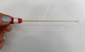 U.K. Researchers Progress Toward Simple Skin Swab Test for Parkinson’s Disease