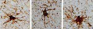Zombie Genes Lurch into Action in Postmortem Brain