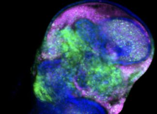 Dietary amino acid determines the fate of cancer cells