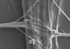 Miniaturized Models Provide a Bigger Picture of ALS