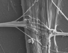 Miniaturized Models Provide a Bigger Picture of ALS