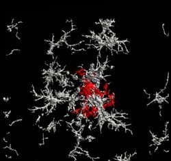 Mouse Model of Alzheimer’s Reveals Some Plaques May Defend and Not Destroy
