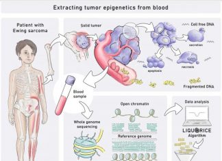 Blood test detects childhood tumors based on their epigenetic profiles