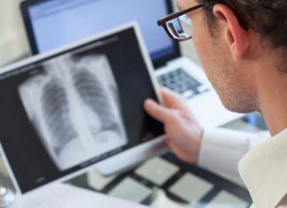 Cizzle Biotechnology begins first day of dealings on London”s main market – Proactive Investors UK