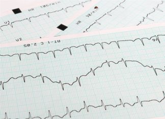Researchers identify new compound that may prevent cardiac arrhythmia risk from common drugs